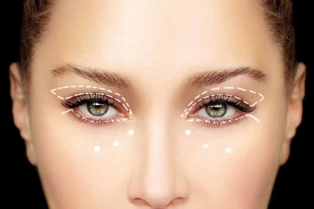 جراحة الجفن في ايران