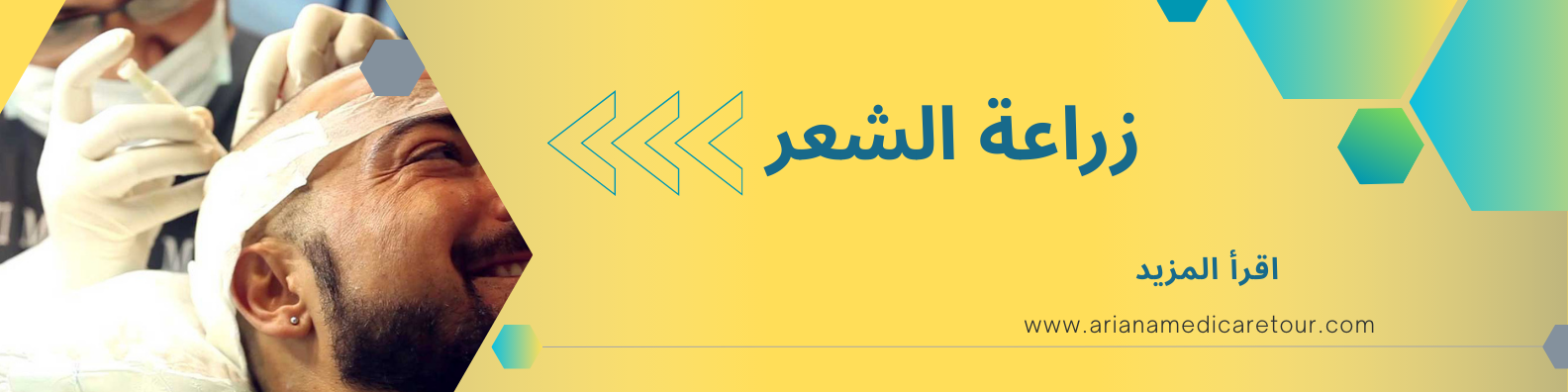 زراعة الشعر في ايران