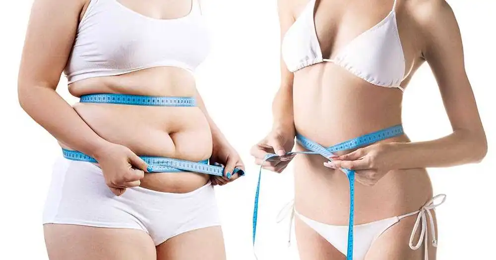 شفط الدهون في ايران بمدن شيراز وطهران