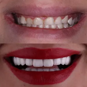 تقويم الأسنان في إيران بمدينة مشهد