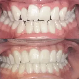 تقويم الأسنان في إيران بمدينة شيراز