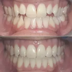 تقويم الأسنان في إيران بمدينة طهران