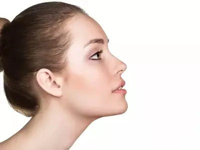 صورة لعمليات تجميل الأنف الترميمية للمرة الثانية