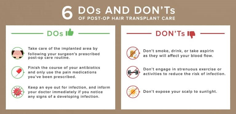 dos and donts hair transplant post op infographics