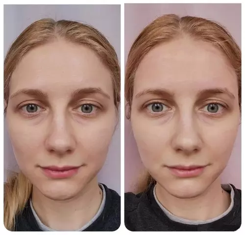 Close-up view of a nose