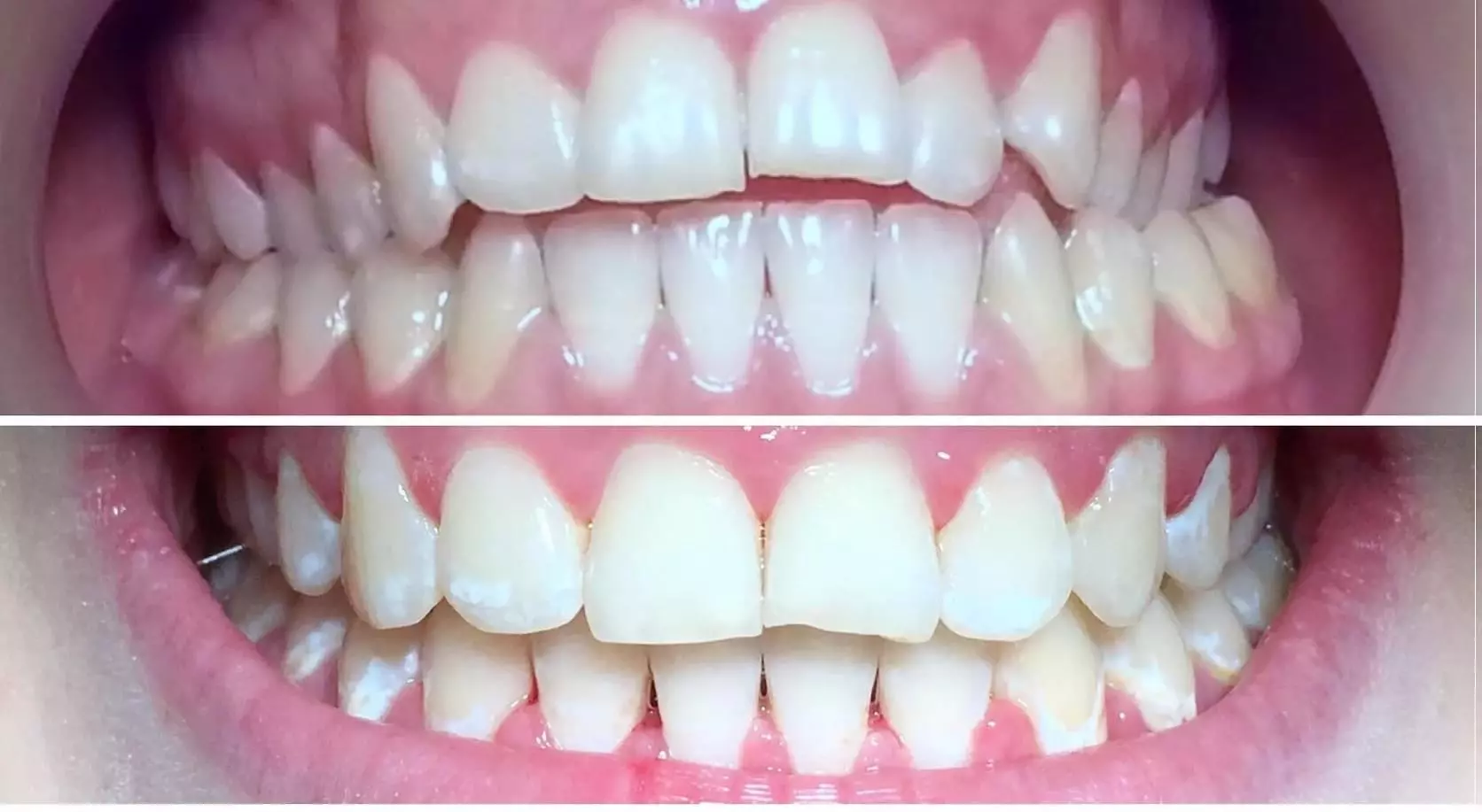 orthodontics in Tehran City