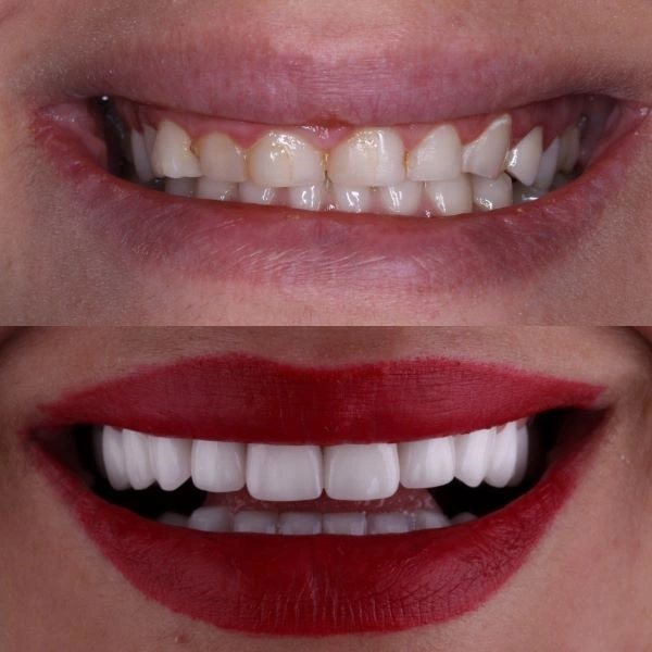 orthodontics in iran at mashhad city