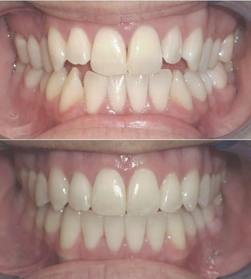 orthodontics in iran at Tehran City