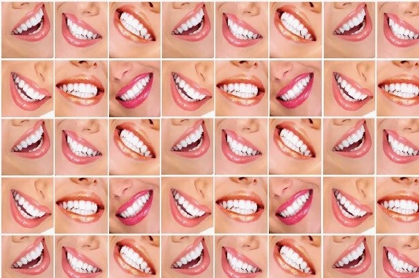 TEETH WHITENING IN IRAN