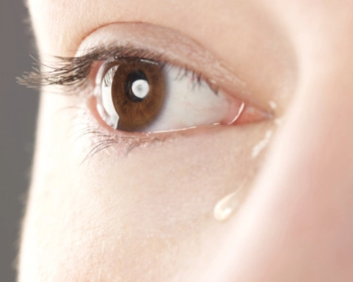 Tear Duct surgery in iran